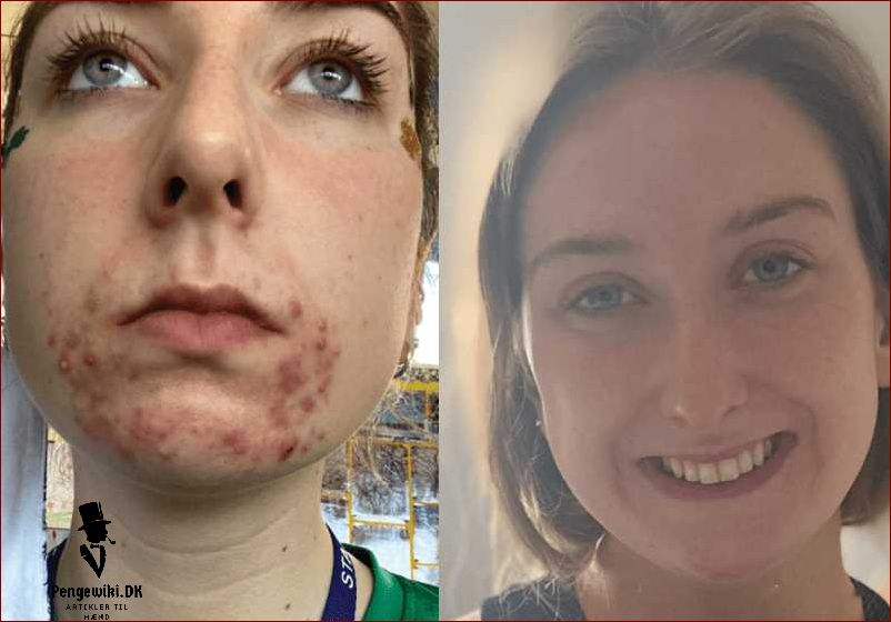 Nøie skincare: Få den bedste pleje til din hud