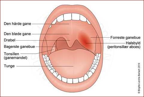 Smag af betændelse i munden - Årsager, symptomer og behandling | Website
